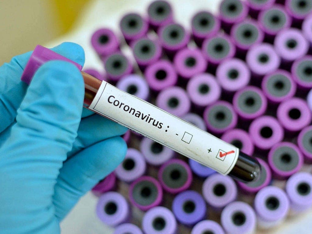 Blog: To know Coronavirus update, Coronavirus tips, Coronavirus prevention, WHO introduced WhatsApp… Image